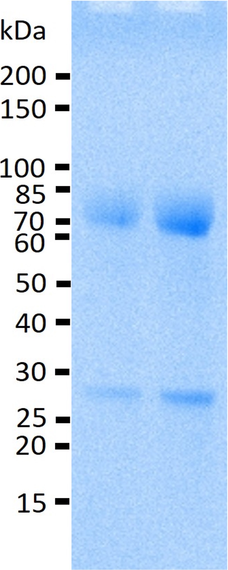 Recombinant Human IL-17 Receptor A/IL-17RA/CD217 (C-Fc)